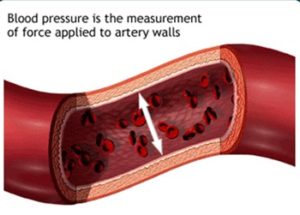 Artery Walls